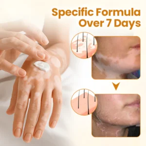 Fivfivgo® VitiCalm Bee Venom Cream