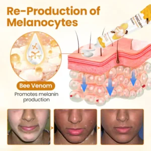 Fivfivgo® VitiCalm Bee Venom Cream