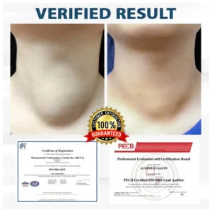 Fivfivgo® VenoHerb Black Cumin Edema Relief Balm