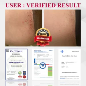 Fivfivgo® Woman's Genital HPV Healing Cream