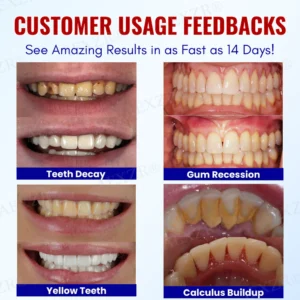 AEXZR® Baking Soda Oral Health Toothpaste