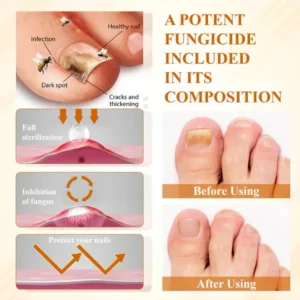 Fivfivgo® Fungiclear Bee Therapy Nail Spray