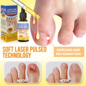Fivfivgo® ClariNail Bee Venom Fungal Solution Drops