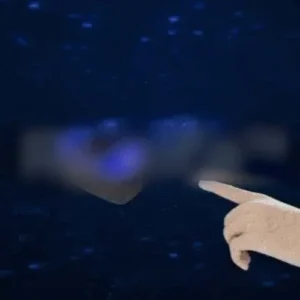 BQYOOM™ High Precision Non-Invasive Blood Glucose Meter