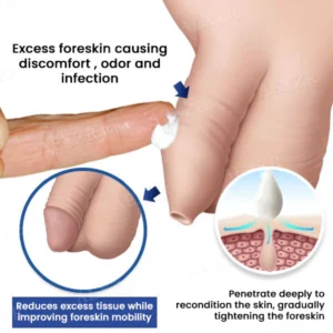 Fivfivgo® Glans Whitening & Foreskin Corrector Cream