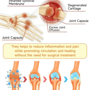 AQA™ Botulinum and Bee Toxin Pain Relief Bone Healing Cream