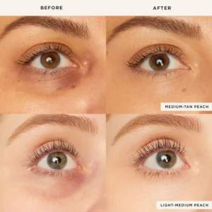 LOVILDS™Colored Clay Undereye Corrector