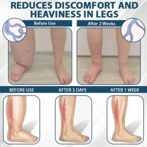 Fivfivgo® VenoHerb Black Cumin Edema Relief Balm