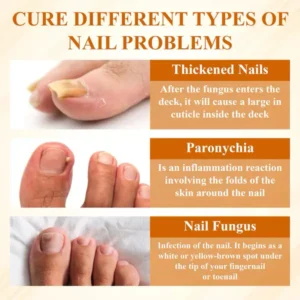 Fivfivgo® Fungiclear Bee Therapy Nail Spray