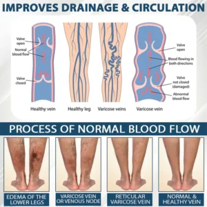 Fivfivgo® VenoHerb Black Cumin Edema Relief Balm