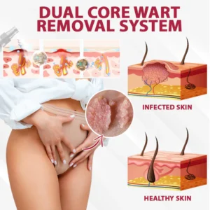 ATTDX® FemGuard Genital HPV Care Spray