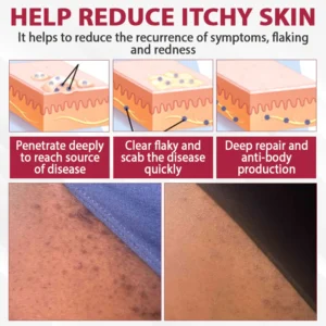 ATTDX® FemGuard Genital HPV Care Spray