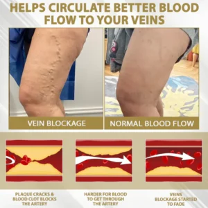 ATTDX® CortiEase Hormonal Swelling Balance Cream 19 ATTDX® CortiEase Hormonal Swelling Balance Cream