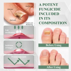 ATTDX® FungaGuard Nail Renewal Herbal Spray