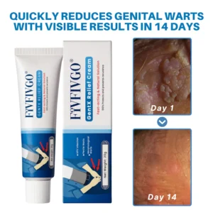 Fivfivgo® HPV Genital Warts Relief Cream