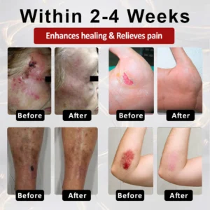 CVREOZ® GlucoseGuard Skin Rescue Cream