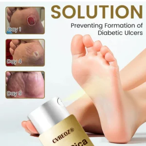 CVREOZ® DiaCure Bee Venom & Centella Diabetic Foot Ulcer Spray