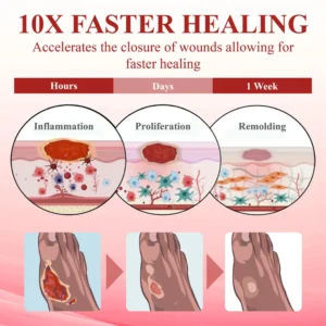 CVREOZ® GlucoseGuard Skin Rescue Cream