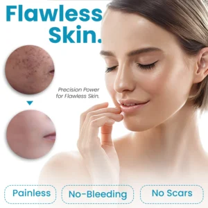 Bikenda® Home Use CO2 Laser Shot Erase Pro