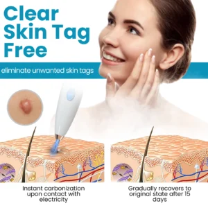 Bikenda® Home Use CO2 Laser Shot Erase Pro