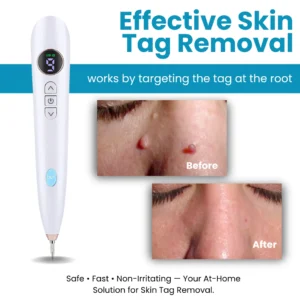 Bikenda® Home Use CO2 Laser Shot Erase Pro 8 Bikenda® Home Use CO2 Laser Shot Erase Pro