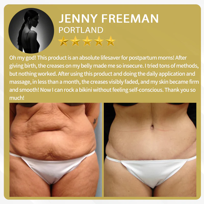 LOVILDS™ Bee Venom Cream — Trusted by Millions for Healthy, Glowing Skin 10 LOVILDS™ Bee Venom Cream — Trusted by Millions for Healthy, Glowing Skin