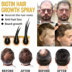 Cvreoz® Biotin Hair Essential Oil!