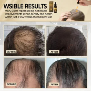 Cvreoz® Biotin Hair Essential Oil!