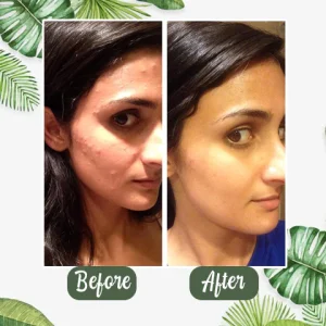 Diystar™ Green Tea Deep Cleanse Mask Stick