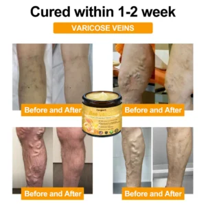 Cougex® Bee Venom Advanced Joint and Bone Healing Cream