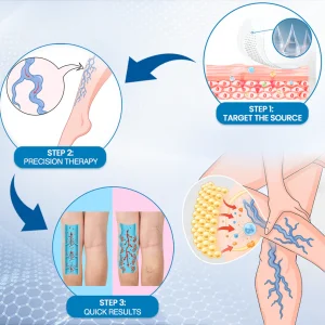 Ourlyard® VeinGuard Pain & Heaviness Microdarts Patch