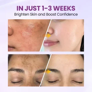 Biancat® RadiantClear Blemish & Brightening Serum