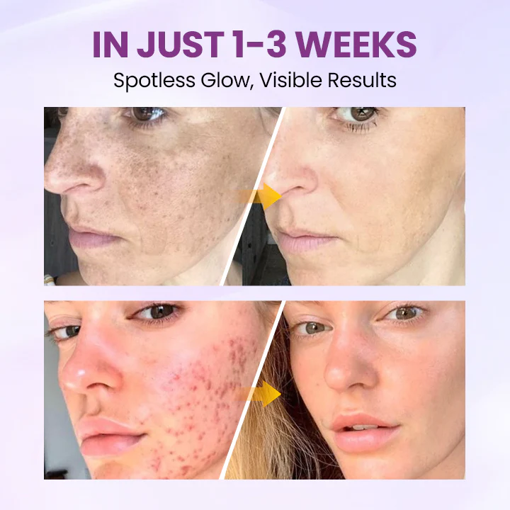 Clinclii™ Radiant Clear Blemish & Brightening Serum 4 Clinclii™ Radiant Clear Blemish & Brightening Serum