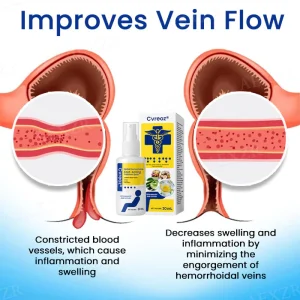 Cvreoz® Herbal Hemorrhoids Fast-Acting Treatment Spray