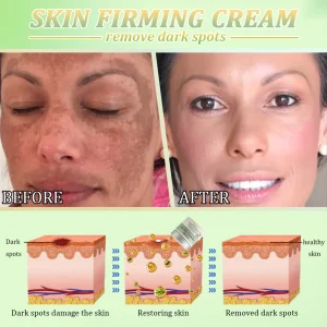 Jorondy® Skin Firming Cream