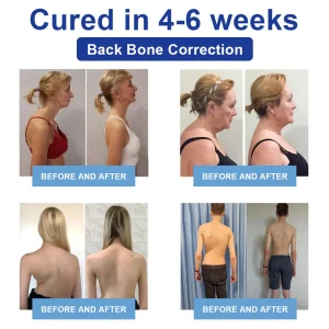 Cvreoz® JointRenew Joint Care Gel Roller Ball