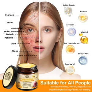 LOVILDS™ Bee Essence Skin Antibacterial Cream