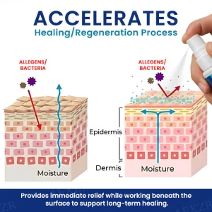 Cvreoz® Genital Treatment Spray