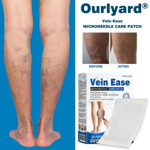Ourlyard® Vein Ease Microneedle Care Patch - Cuttable