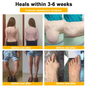 ODALIT™ Botulinum Toxin & Bee Venom Pain-Relief Bone Healing Cream