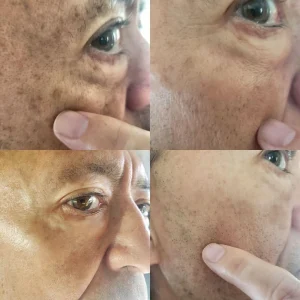 Melanin Correcting Brightening Serum