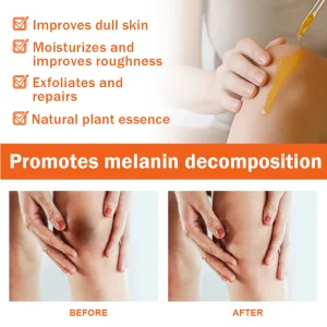 Dobshow® Acanthosis Nigricans Treatment Oil