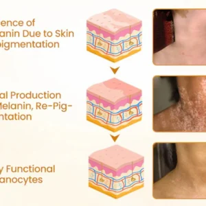 Newyuo® VitiCalm Bee Venom Cream