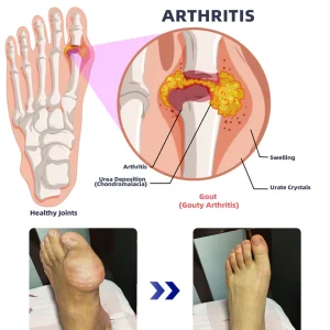 ADFIRE™ Dual Action Joint Therapy Cream