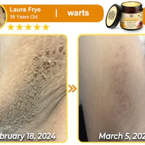 LOVILDS™ Bee Essence Skin Antibacterial Cream