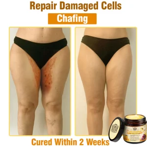 LOVILDS™ Bee Essence Skin Antibacterial Cream