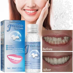 ToothEasePro™ Dental Filling Gel