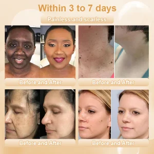 JORONDY® Bee Bright Kolirin Advanced Cream