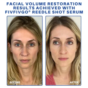Fivfivgo® PDRN-NAD+ Cica Reedle Shot Serum