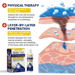 LUHAKA® SKIN TAG CRYO TREATMENT SPRAY ACE